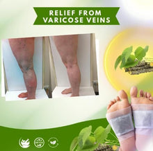 Load image into Gallery viewer, Herbal Giloy Patches (Pack of 2) 20pcs
